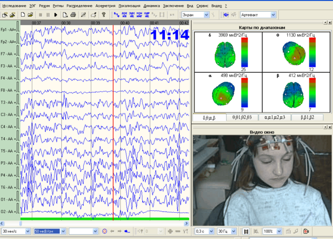 Screen Shot 2017-02-23 at 14.51.41